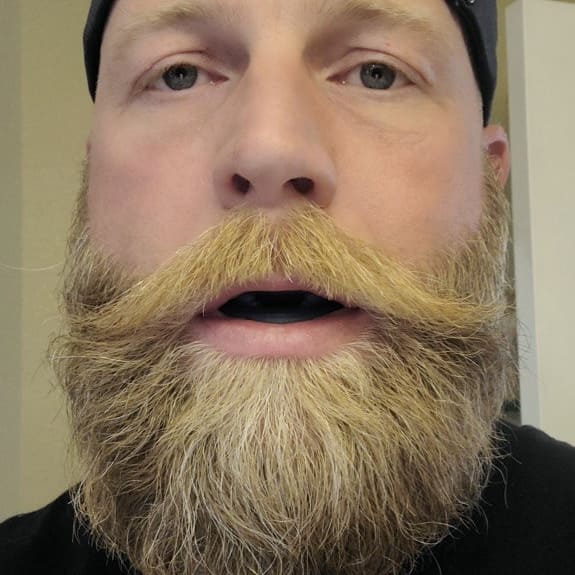 RinovaX™ – Bite anti-russamento silenzioso universale