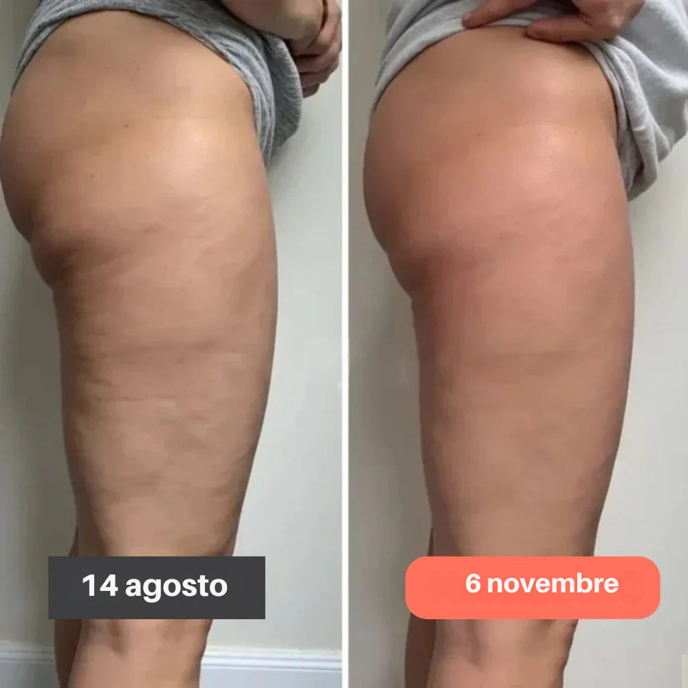 Leggings 3D Seliro– Ridefinisci la tua silhouette senza sforzo.