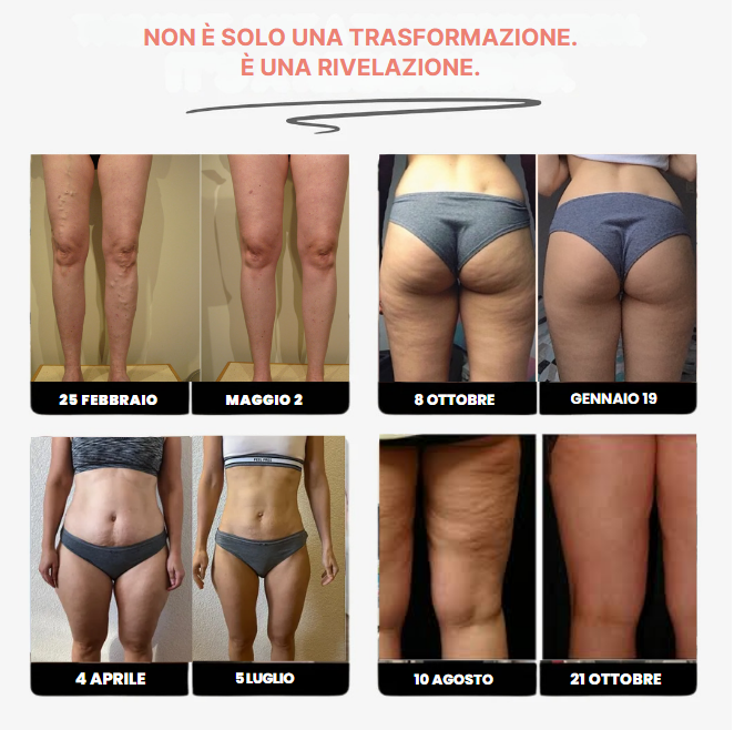 Leggings 3D Seliro– Ridefinisci la tua silhouette senza sforzo.